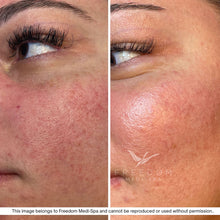 Load image into Gallery viewer, The Skin Strategy Session