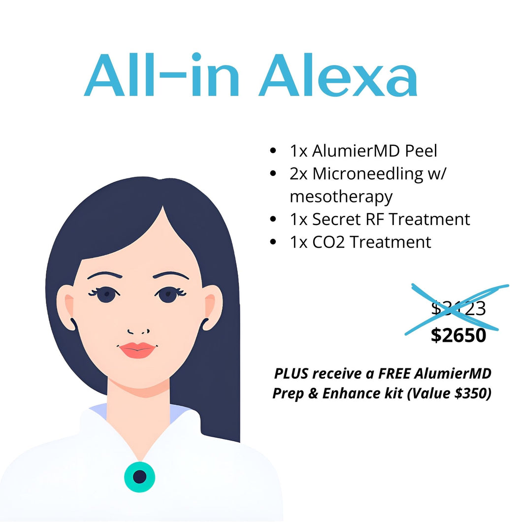 All-In-Alexa