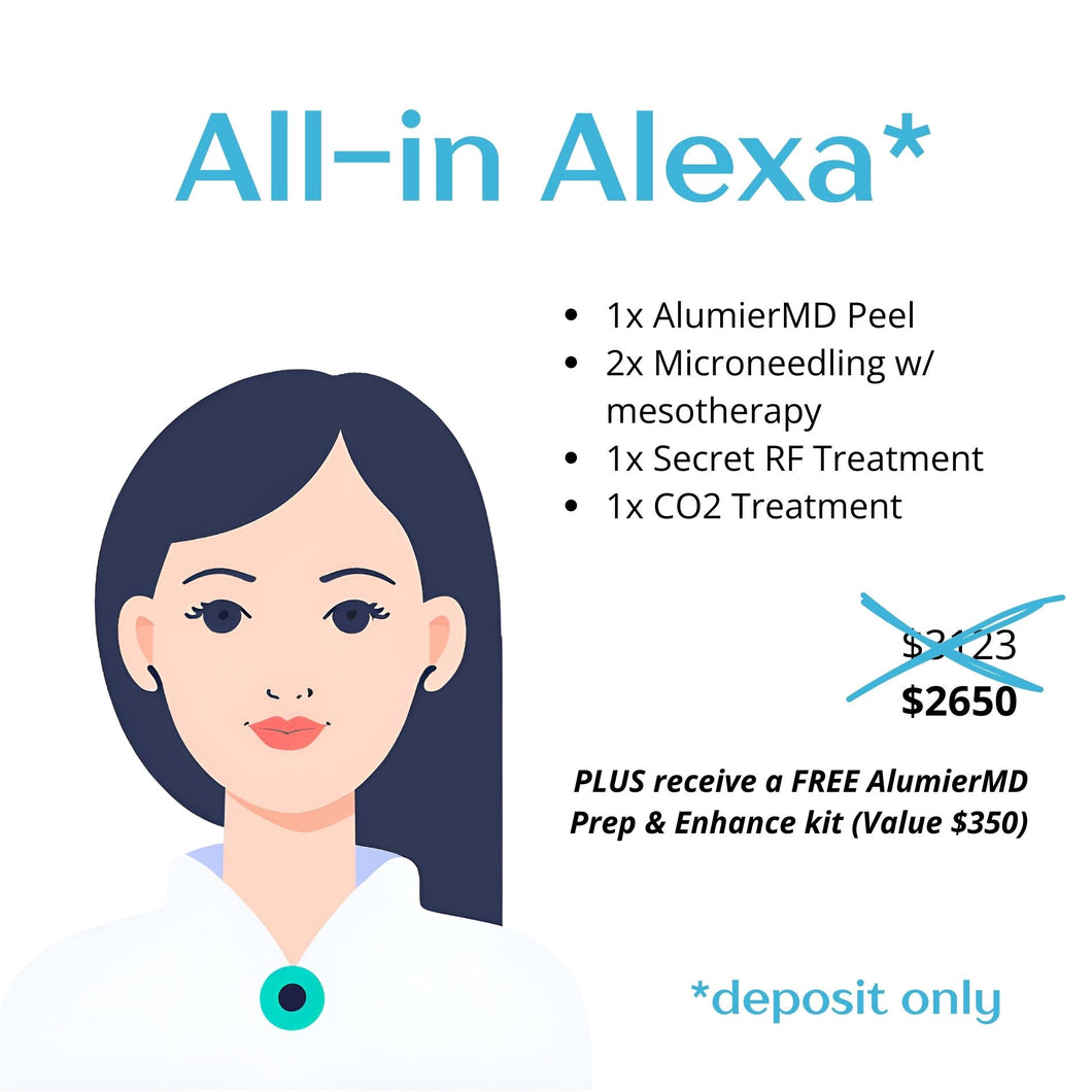 All-In-Alexa  DEPOSIT ONLY