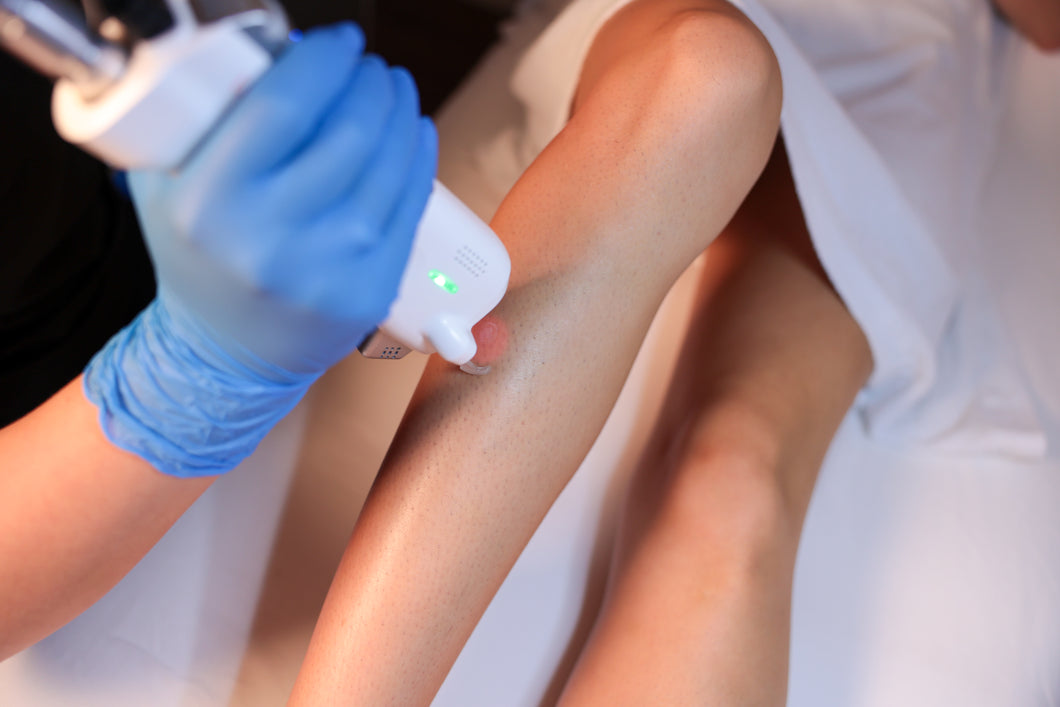 Laser Hair Removal - Full Legs