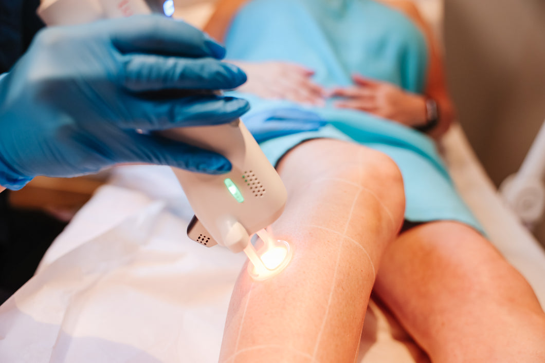 Laser Hair Removal - Lower Legs