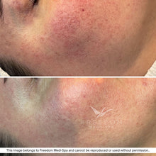 Load image into Gallery viewer, The Skin Strategy Session
