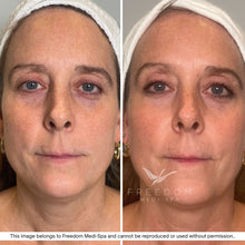 Load image into Gallery viewer, The Skin Strategy Session
